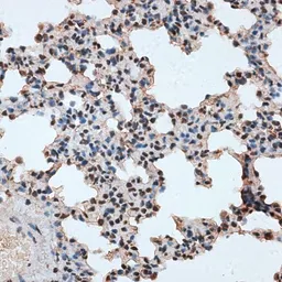 Anti-RBM17 antibody used in IHC (Paraffin sections) (IHC-P). GTX64861