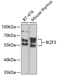 Anti-IKZF3 antibody used in Western Blot (WB). GTX64869