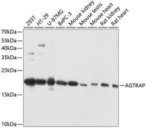 Anti-AGTRAP antibody used in Western Blot (WB). GTX64875