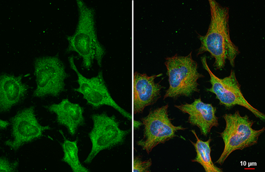 Anti-ATIC antibody [HL6383] used in Immunocytochemistry/ Immunofluorescence (ICC/IF). GTX648822