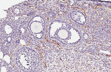 Anti-CD146 antibody [HL6385] used in IHC (Paraffin sections) (IHC-P). GTX648824