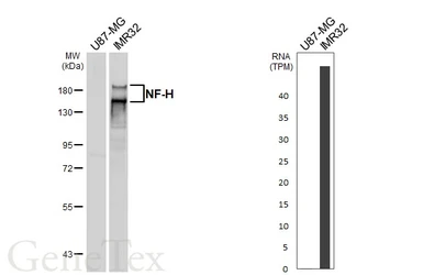 Anti-NF-H antibody [HL6395] used in Western Blot (WB). GTX648840