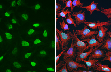 Anti-DDX23 antibody [HL6398] used in Immunocytochemistry/ Immunofluorescence (ICC/IF). GTX648843