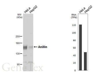 Anti-Anillin antibody [HL6408] used in Western Blot (WB). GTX648853