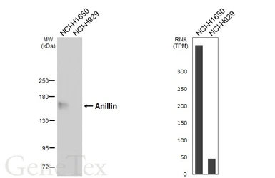 Anti-Anillin antibody [HL6408] used in Western Blot (WB). GTX648853