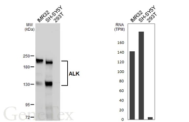 Anti-ALK antibody [HL6409] used in Western Blot (WB). GTX648854