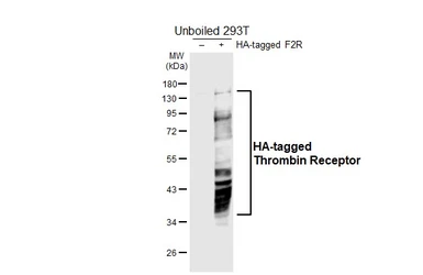 Anti-Thrombin Receptor antibody [HL6410] used in Western Blot (WB). GTX648855
