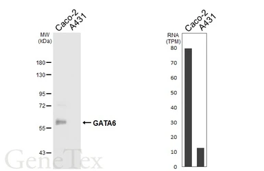 Anti-GATA6 antibody [HL6413] used in Western Blot (WB). GTX648858