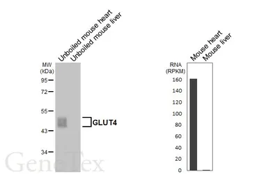Anti-GLUT4 antibody [HL6419] used in Western Blot (WB). GTX648864