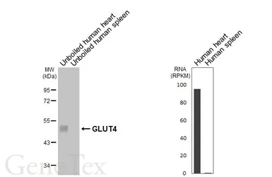 Anti-GLUT4 antibody [HL6419] used in Western Blot (WB). GTX648864