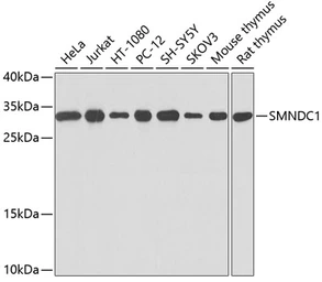 Anti-SMNDC1 antibody used in Western Blot (WB). GTX64887