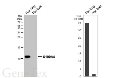 Anti-S100A4 antibody [HL6435] used in Western Blot (WB). GTX648880