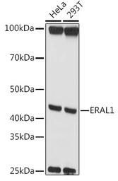 Anti-ERAL1 antibody used in Western Blot (WB). GTX64890