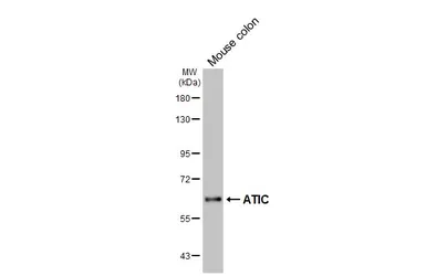 Anti-ATIC antibody [HL6465] used in Western Blot (WB). GTX648913