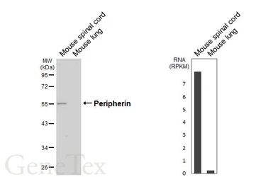 Anti-Peripherin antibody [HL6471] used in Western Blot (WB). GTX648919