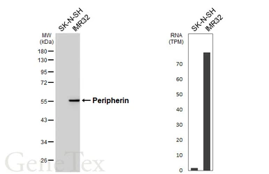 Anti-Peripherin antibody [HL6471] used in Western Blot (WB). GTX648919