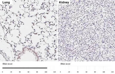 Anti-NKX2.1 antibody [HL6474] used in IHC (Paraffin sections) (IHC-P). GTX648922