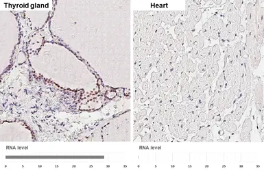 Anti-NKX2.1 antibody [HL6474] used in IHC (Paraffin sections) (IHC-P). GTX648922