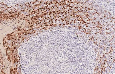 Anti-S100A8 antibody [HL6492] used in IHC (Paraffin sections) (IHC-P). GTX648948