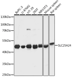 Anti-SLC25A24 antibody used in Western Blot (WB). GTX64897