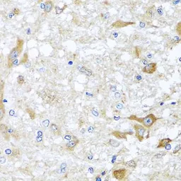 Anti-ABCB8 antibody used in IHC (Paraffin sections) (IHC-P). GTX64900