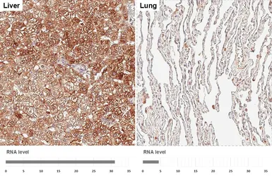 Anti-AMACR antibody [HL6548] used in IHC (Paraffin sections) (IHC-P). GTX649018