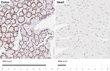 Anti-FOXP1 antibody [HL6571] used in IHC (Paraffin sections) (IHC-P). GTX649041