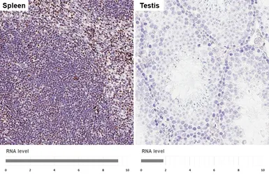 Anti-FOXP1 antibody [HL6571] used in IHC (Paraffin sections) (IHC-P). GTX649041