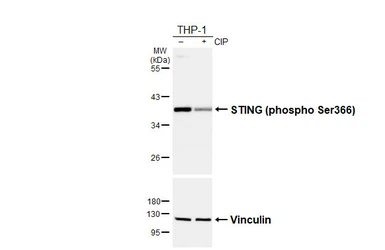 Anti-STING (phospho Ser366) antibody [HL6579] used in Western Blot (WB). GTX649049