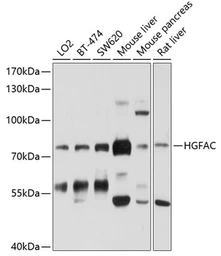 Anti-HGF activator antibody used in Western Blot (WB). GTX64906