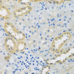 Anti-PMPCB antibody used in IHC (Paraffin sections) (IHC-P). GTX64915
