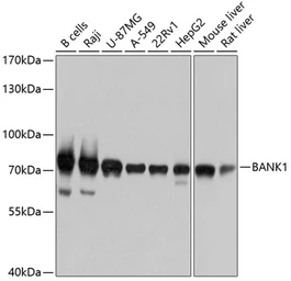 Anti-BANK1 antibody used in Western Blot (WB). GTX64930