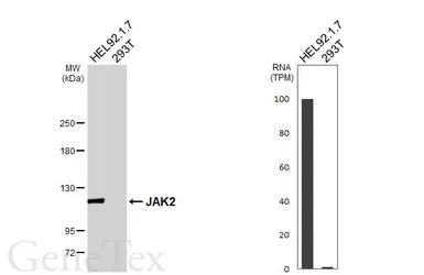 Anti-JAK2 antibody [HL6611] used in Western Blot (WB). GTX649311