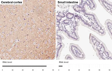 Anti-Hexokinase 1 antibody [HL6617] used in IHC (Paraffin sections) (IHC-P). GTX649317