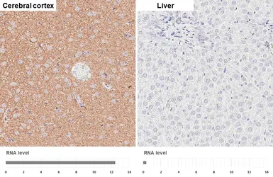 Anti-Hexokinase 1 antibody [HL6617] used in IHC (Paraffin sections) (IHC-P). GTX649317