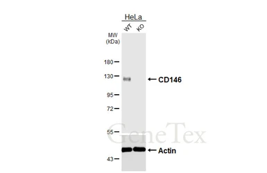 Anti-CD146 antibody [HL6624] used in Western Blot (WB). GTX649324