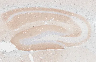 Anti-Kv4.2 antibody [GT433] used in IHC (Paraffin sections) (IHC-P). GTX649342