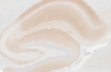 Anti-Kv4.2 antibody [GT433] used in IHC (Paraffin sections) (IHC-P). GTX649342