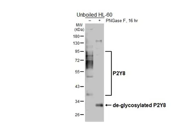 Anti-P2Y8 antibody [HL6649] used in Western Blot (WB). GTX649358