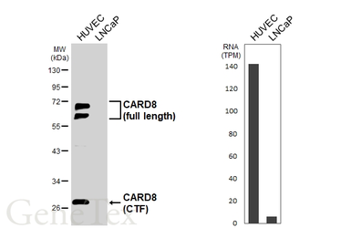 Anti-CARD8 antibody [HL6656] used in Western Blot (WB). GTX649365