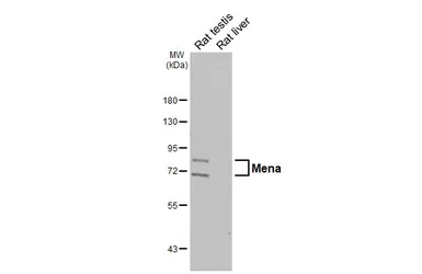 Anti-Mena antibody [HL6672] used in Western Blot (WB). GTX649381