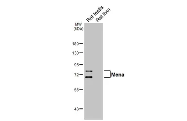 Anti-Mena antibody [HL6673] used in Western Blot (WB). GTX649382