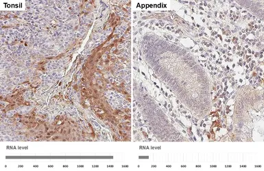 Anti-Cystatin B antibody [HL6675] used in IHC (Paraffin sections) (IHC-P). GTX649384