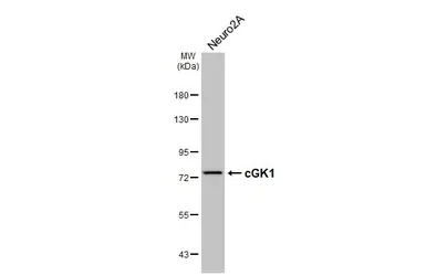 Anti-cGK1 antibody [HL6677] used in Western Blot (WB). GTX649388