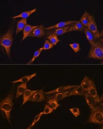 Anti-BDKRB2 antibody used in Immunocytochemistry/ Immunofluorescence (ICC/IF). GTX64939