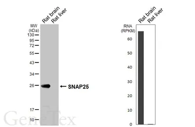 Anti-SNAP25 antibody [HL6681] used in Western Blot (WB). GTX649392