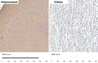 Anti-SNAP25 antibody [HL6681] used in IHC (Paraffin sections) (IHC-P). GTX649392
