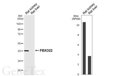 Anti-FBXO22 antibody [HL6682] used in Western Blot (WB). GTX649393