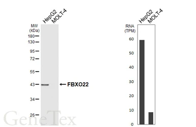 Anti-FBXO22 antibody [HL6682] used in Western Blot (WB). GTX649393