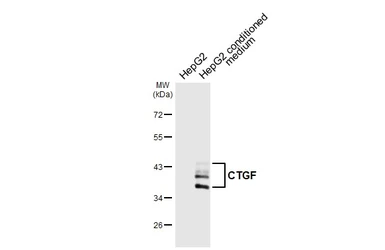 Anti-CTGF antibody [HL6685] used in Western Blot (WB). GTX649396